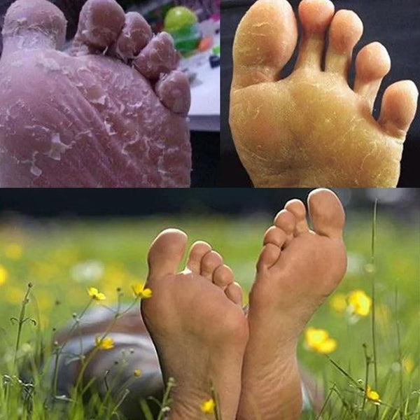 Anti-fungal Exfoliating Detox Foot Soak