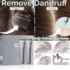 Dandruff Anti Hair Loss Scalp Cleaning Gel - Yousweety