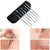 7pcs Pimple Blemish Comedone Acne Needle Extractor Remover Tools Set